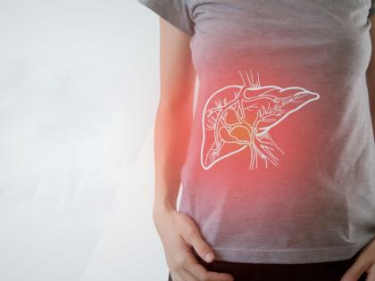 Symptoms and causes of liver cirrhosis myb | खाण्यापिण्याच्या 'या' चुका लिव्हर सिरोसिसला ठरतात कारणीभूत, जाणून घ्या लक्षणं