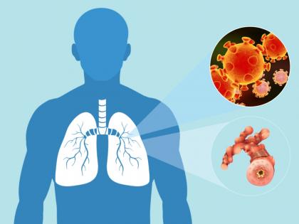 Coronavirus : How the virus affects the body