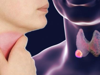 Know the symptoms of thyroid cancer myb | घशातील वेदना असू शकतो थायरॉईड कॅन्सरचा संकेत, जाणून घ्या लक्षणं आणि उपाय