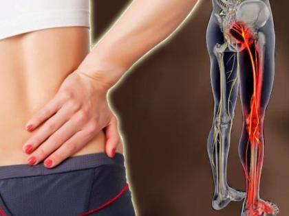 Daily habit that cause sciatica pain myb | रोजच्या चुकीच्या सवयींमुळे 'या' गंभीर समस्यांचे होत आहात शिकार, जाणून घ्या कसे