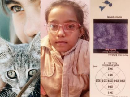 Cat minor girl ill toxopara canis eye site third case kanpur uttar pradesh | अरेरे! मांजरीसह खेळणं चिमुरडीला चांगलंच भारी पडलं; खेळण्याच्या नादात गमवावी लागली दृष्टी