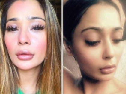 Sara Khan Looks Horrible After Plastic Surgery | बाबो ,अधिक सुंदर दिसण्याच्या नादात अभिनेत्रीनं चेह-याची अक्षरश: लावली वाट