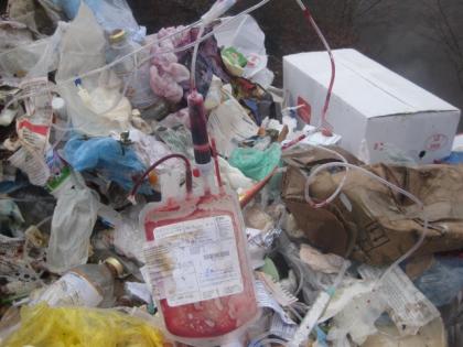 Shocking! Organic waste exposed in Kalyan Dombivali! Danger pickers' lives in danger | धक्कादायक! कल्याण डोंबिवलीत जैविक कचरा उघड्यावर ! कचरा उचलणा-या कर्मचा-यांचा जीव धोक्यात 