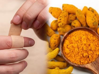 Turmeric bandage : Odisha Scientist heal wounds faster even for diabetic patients | Turmeric bandage : भारतीय वैज्ञानिकांनी बनवलं हळदीचं बँडेज; जखम लवकर बरी होण्यासह डायबिटीस रुग्णांसाठी फायदेशीर