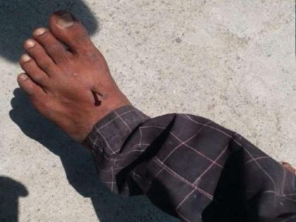 bareilly police accused of hitting nails in hand and leg of man not wearing mask | भयंकर! मास्क लावला नसल्याने पोलिसांनी मुलाच्या हातापायात ठोकला खिळा; महिलेचा गंभीर आरोप