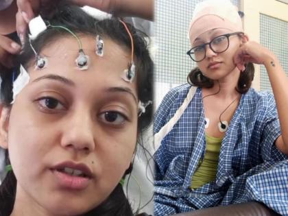 Why did Marathi actress Ketki Chitale have to undergo electric shock? | मराठमोळी अभिनेत्री केतकी चितळेला का घ्यावा लागला इलेक्ट्रिक शॉक?, कारण वाचून व्हाल हैराण