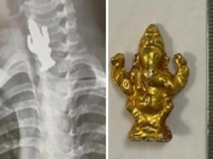 3 year old boy swallows ganesha idol survives after medical treatment in bengaluru | अरे देवा! 3 वर्षीय चिमुकल्याने गिळली गणपतीची मूर्ती, एक्स-रे पाहून डॉक्टरही झाले हैराण अन्...