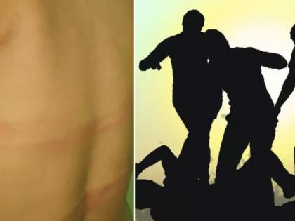 beaten for wearing short clothes, molestation of 2 young women in kalyan | संतापजनक! तोकडे कपडे घातल्याचा जाब विचारत बेदम मारहाण, दोघींचा विनयभंग 