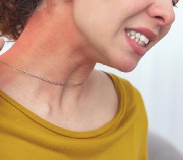 Fake jewellery : खोट्या दागिन्यांमुळे होतात 5 स्किन प्रॉब्लेम; डॉक्टरांनी सांगितली ॲलर्जीची कारणं, उपाय