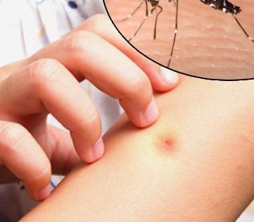 संध्याकाळ होताच तुमचंही घर डासांनी भरतं? पावसाळ्यात जीवघेण्या आजारांना लांब ठेवण्यासाठी 'अशी' घ्या काळजी