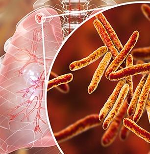 CoronaVirus : अलर्ट : कोरोनातून बरं झाल्यानंतर उद्भवतोय 'हा' जीवघेणा आजार; समोर आली नवी लक्षणं