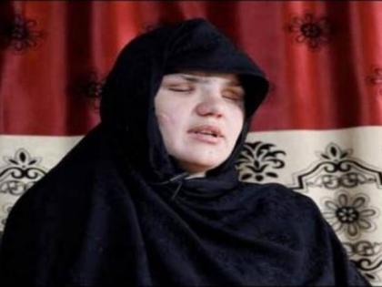 Afghanistan Taliban Crisis taliban kidnapped me shot me in head and took out my eyes says afghan woman | Afghanistan Taliban Crisis : हृदयद्रावक! "तालिबानींनी माझं अपहरण केलं, डोक्यात गोळ्या झाडल्या आणि नंतर काढले डोळे"