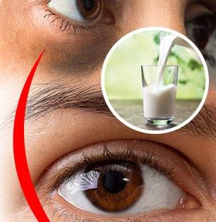 How to remove Dark circles : दुधाच्या वापरानं डोळ्यांखालची काळी वर्तुळं कायमची घालवा; काही मिनिटात दिसेल ग्लोईंग चेहरा