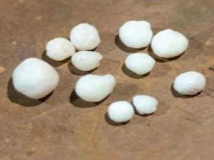 woman found 12 pearls while eating oyster | शिंपले खाता खाता महिलेचं नशिबचं खुललं, झाली रातोरात मालामाल, फक्त केलं 'हे' काम