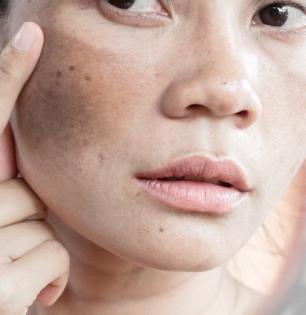 Skin Care Tips : चेहरा खूप थकल्यासारखा, वयस्कर वाटतोय? 'हा' उपाय वापरा, त्वचेचे विकार कायम राहतील लांब