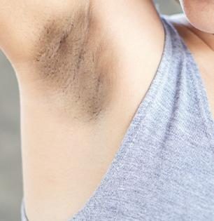 Darkness of underarms: अंडरआर्म्सचा काळपटपणा वाढतो कारण 3 चुका; करा २ घरगुती उपाय