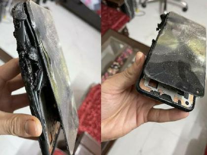 oneplus nord 2 allegedly blast during phone call user injured | OnePlus Nord 2 : भयंकर! फोनवर बोलत असतानाच झाला OnePlus Nord 2 चा भीषण स्फोट; युजर जखमी