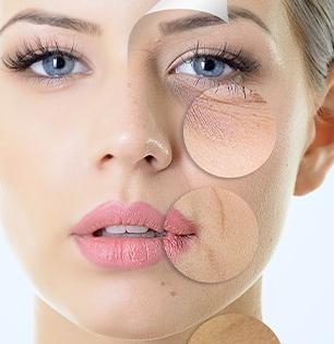 Wrinkle Prevention Tips : वय कमी पण चेहरा वयस्कर दिसतोय? फक्त ५ उपाय; सुरकुत्या, वयवाढीच्या खुणा कायमच्या राहतील लांब