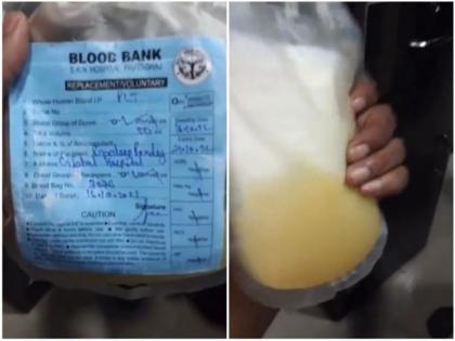 prayagraj dengue patient given fake plasma mausami juice accused global hospital sealed up | Video - डेंग्यूच्या रुग्णाला प्लेटलेट्स ऐवजी दिला मोसंबीचा ज्यूस; रुग्णालयातील प्रकाराने खळबळ