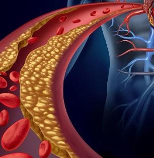 What Reduces Cholesterol Quickly : बॅड कॉलेस्टेरॉल वाढल्याचे संकेत देतात साधी वाटणारी ५ लक्षणं, समजून घ्या उपाय