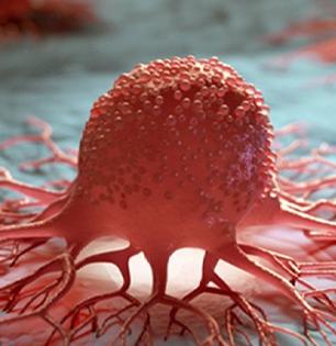 Sanitory pads cancer : सॅनिटरी पॅड्स वापरल्यानं होऊ शकतो जीवघेणा कॅन्सर? नवीन रिसर्चमध्ये खुलासा