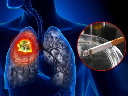 Did You Know? 50 percent of non smokers are at risk of lung cancer