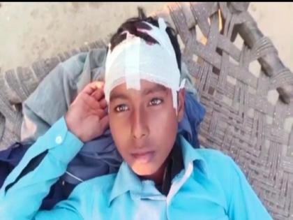 student was answering maths questions teacher got angry grabbed hair and hit him on ground head injury | क्रूरतेचा कळस! प्रश्नाचं उत्तर न आल्याने शिक्षकाने विद्यार्थ्याला जमिनीवर पाडलं, डोकंच फोडलं अन्...