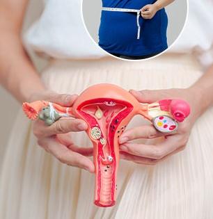 Effective weight loss tips for women With PCOS