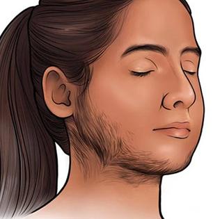 चेहऱ्यावर खूप केस आहेत? करून पाहा ५ रुपयांच्या तुरटीचा १ सोपा उपाय, काही मिनिटांत त्वचा उजळेल
