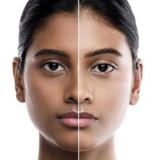 उन्हामुळे चेहरा काळवंडला? चमक हरवली? बटाट्याच्या रसात मिसळा ३ पैकी १ गोष्ट; चेहरा चमकेल..