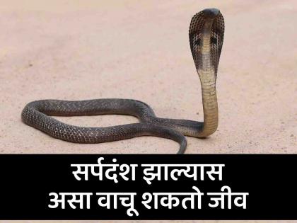 If you take precautions after snakebite, you can save your life! | सर्पदंशानंतर खबरदारी घेतल्यास वाचू शकतो जीव !