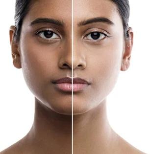 चेहरा - मान काळवंडली? चमचाभर हळदीचा सोपा उपाय - १० मिनिटात टॅनिंग गायब - नितळ त्वचेचं सिक्रेट