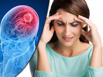 brain tumor 7 early symptoms most people ignore it | ब्रेन ट्यूमरच्या 'या' ७ संकेतांकडे दुर्लक्ष करणं ठरू शकतं जीवघेणं, सुरुवातीलाच व्हा सावध