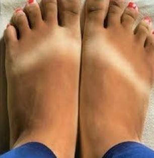 हिवाळा सुरु होताच हातपाय काळेकुट्ट झाले? खोबरेल तेलात घाला १ गोष्ट- पाहा मऊमऊ जादू