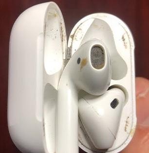 How can I clean the inside of my EarPods? How to clean EarPods for better sound? Best Way to CLEAN EarPods & Fix Volume Issues! | रोज वापरुन मळलेले कॉड्स करा झटपट स्वच्छ, घरच्याघरीच करुन पाहा ही ट्रिक, कॉड्स दिसतील नव्यासारखे...