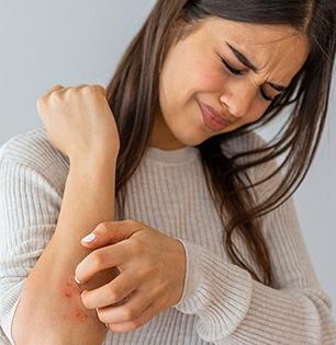 हिवाळ्यात अंगावर पित्त येऊन खूप खाज सुटते? बघा का होतो शीतपित्ताचा त्रास आणि त्यावरचे उपाय 