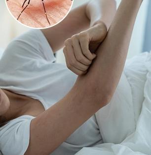 डासांनी कडाकड चावून हैराण केलं? २ सोपे उपाय- डास तुमच्या घराच्या आसपासही फिरकणार नाहीत 