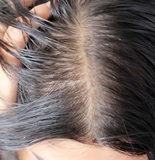 केस खूप गळतात? खोबरेल तेलात २ पदार्थ टाकून मालिश करा, केस वाढतील भराभर- हाेतील दाट