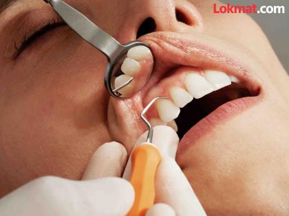 Don't have money for dental treatment? Get treatment at a government hospital for just thousand rupees | दातांवरील उपचार करण्यासाठी पैसे नाहीत? शासकीय रुग्णालयात करा केवळ हजार रुपयात उपचार Don't have money for dental treatment? Get treatment at a government hospital for just thousand rupees | दातांवरील उपचार करण्यासाठी पैसे नाहीत? शासकीय रुग्णालयात करा केवळ हजार रुपयात उपचार