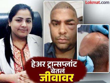 one more engineer patient of doctor anushka tiwari died after hair transplant in kanpur | चेहरा सुजला, आईच्या कुशीतच जीव सोडला; हेअर ट्रान्सप्लांटमुळे आणखी एका तरुणाचा मृत्यू one more engineer patient of doctor anushka tiwari died after hair transplant in kanpur | चेहरा सुजला, आईच्या कुशीतच जीव सोडला; हेअर ट्रान्सप्लांटमुळे आणखी एका तरुणाचा मृत्यू