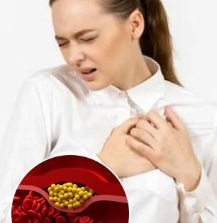 तेलकट- तुपकट न खाताही कोलेस्टेरॉल वाढतं? तज्ज्ञ सांगतात ५ गोष्टी करा- कोलेस्टेरॉल कमी होईल 