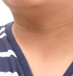 मळ साचून मुलांची मान, हाताचे कोपरे काळे पडले? १ सोपा उपाय- ५ मिनिटांत दिसतील स्वच्छ