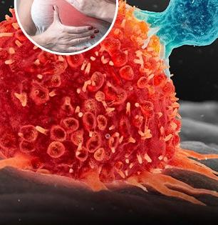 रात्री ब्रा घालून झोपल्यानं खरंच ब्रेस्ट कॅन्सर होतो का? कॅन्सर आणि ब्रा घालण्याचा काय संबंध, वाचा..