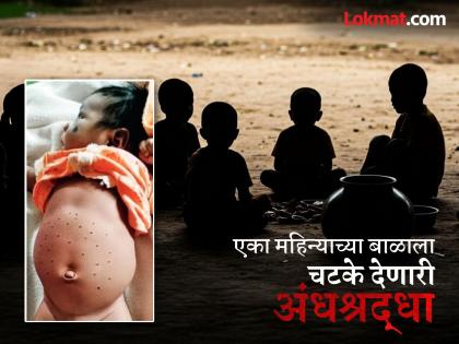 A 1-month-old baby was given a hot sickle to scald his stomach; Aghori practice is still practiced in Melghat under the name of treatment | १ महिन्याच्या बाळाला गरम विळ्याने पोटाला दिले चटके; मेळघाटात अजूनही उपचाराच्या नावाखाली चालतो अघोरी प्रकार A 1-month-old baby was given a hot sickle to scald his stomach; Aghori practice is still practiced in Melghat under the name of treatment | १ महिन्याच्या बाळाला गरम विळ्याने पोटाला दिले चटके; मेळघाटात अजूनही उपचाराच्या नावाखाली चालतो अघोरी प्रकार