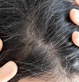 डोक्यावर पांढरे केस चमकतात? ५ रूपयांचा कढीपत्ता 'या' पद्धतीनं लावा; काळेभोर होतील केस