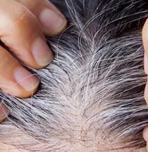 पांढरे केस जास्तच वाढलेत? १ घरगुती उपाय, डाय-मेहेंदी काहीच न लावता काळेभोर होतील केस