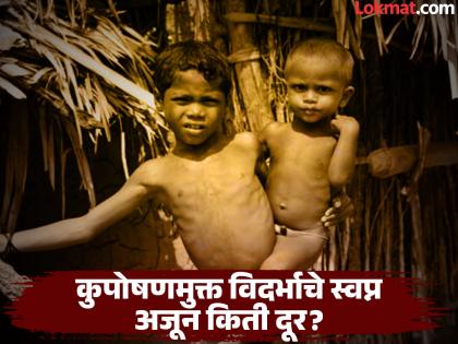पूर्व विदर्भातील कुपोषणाचे चित्र भयावह ! भंडाऱ्यात ६३८ तीव्र, ३६५३ मध्यम कुपोषित बालके