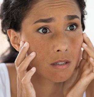 October heat : उन्हामुळे काळवंडलेली त्वचा होईल सुंदर, करा हे घरगुती उपाय