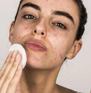 टीनएजर्ससाठी अलर्ट! सुंदर दिसण्याची हौस भलतीच महागात; 'स्किनकेअर'ची क्रेझ धोकादायक