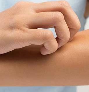 हिवाळ्यात त्वचा कोरडी आणि पांढरी फटफटीत होते? फक्त ५ उपाय, त्वचा होईल मऊ मुलायम कापसासारखी